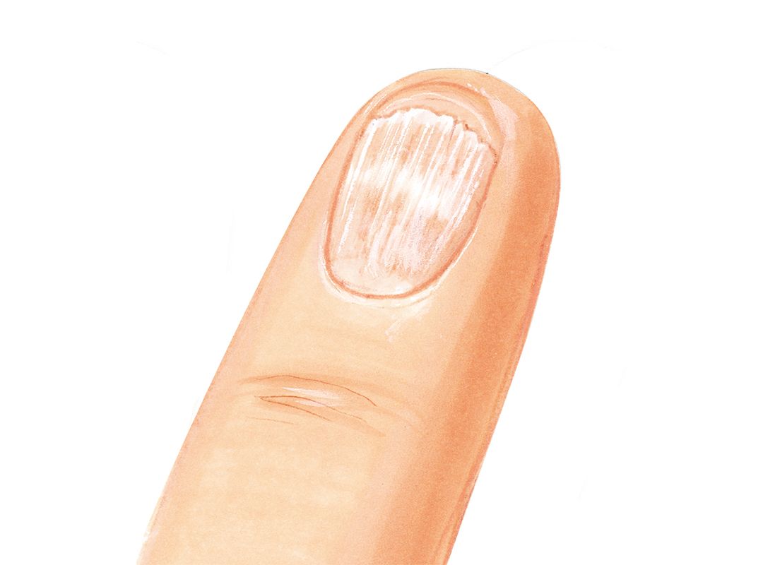 Jessica Nails Analysis After Acrylic
