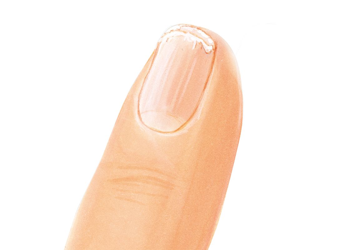 Jessica Nails Analysis Peeling